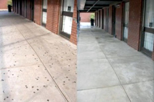 gum removal